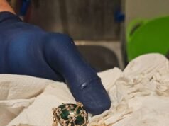 La police récupère un pendentif Fabergé inspiré de James Bond dans les entrailles d’un homme accusé de l’avoir mangé